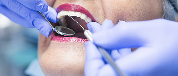 Best Emergency Dental Care for Sports Injuries in Brookmont, MD