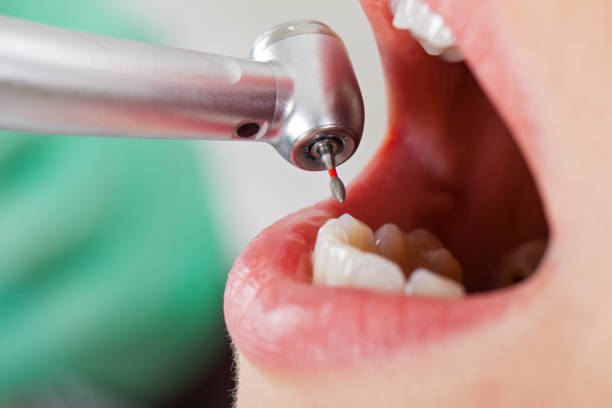 Best After-Hours Dental Care in Brookmont, MD